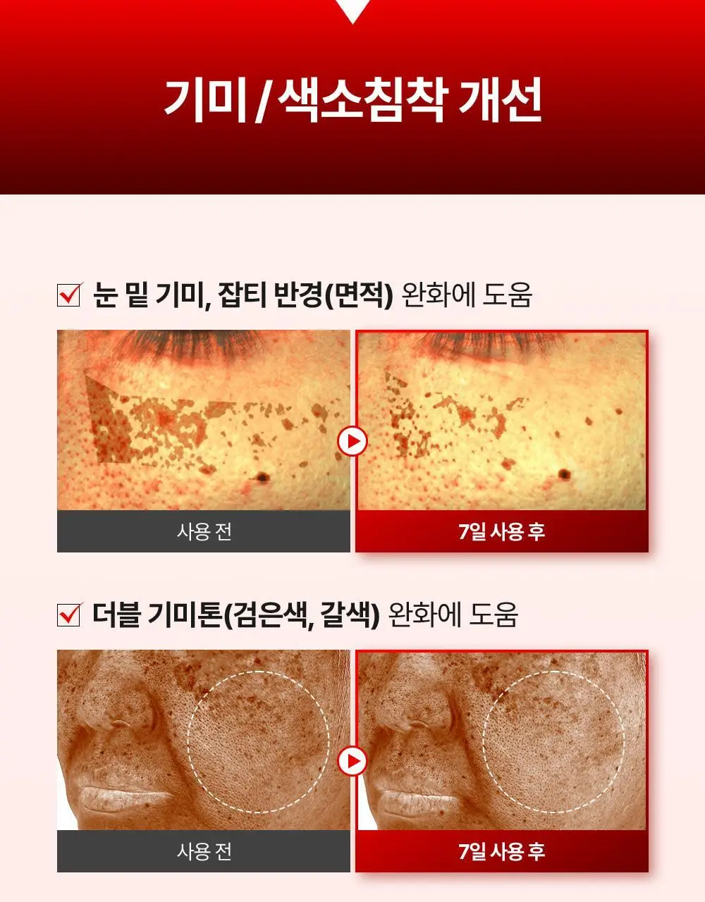 [기미잡티] 메디필 멜라논엑스 앰플 RX 30ml 상세페이지 29